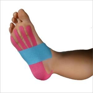 kinesio tape and plantar fasciitis