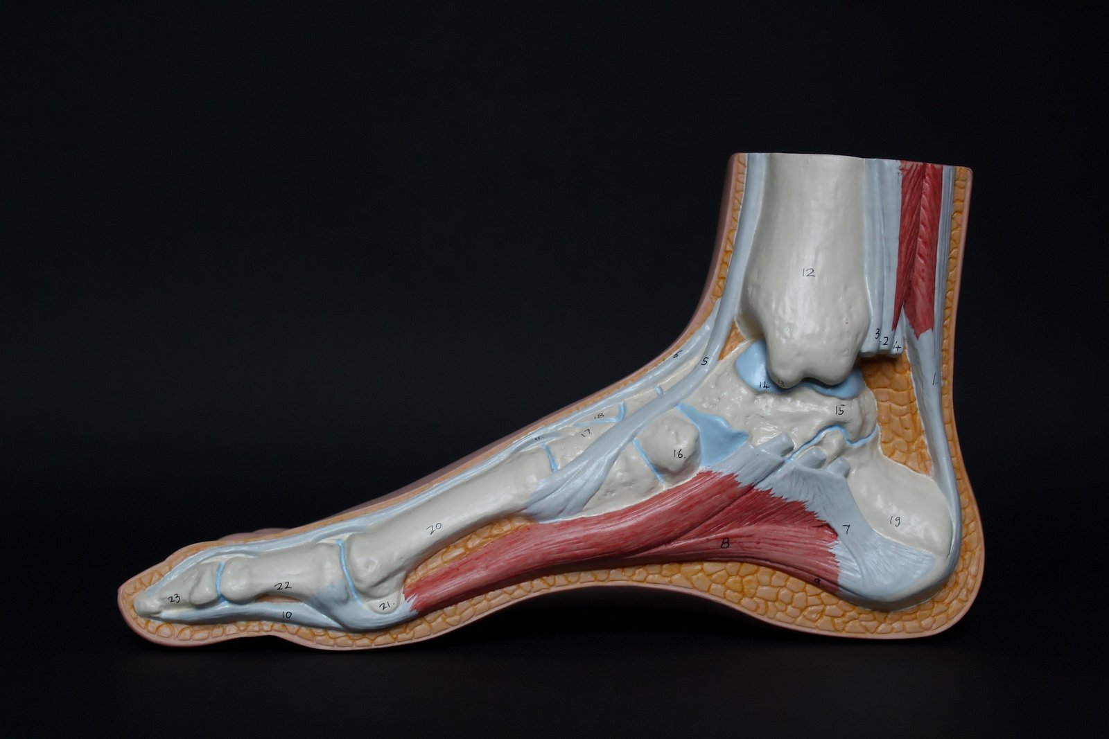 plantar fasciitis torn foot anatomy