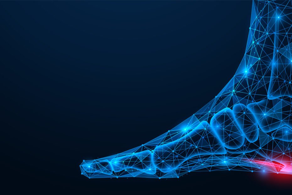 plantar fasciitis causes