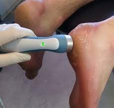 ultrasound for plantar fasciitis