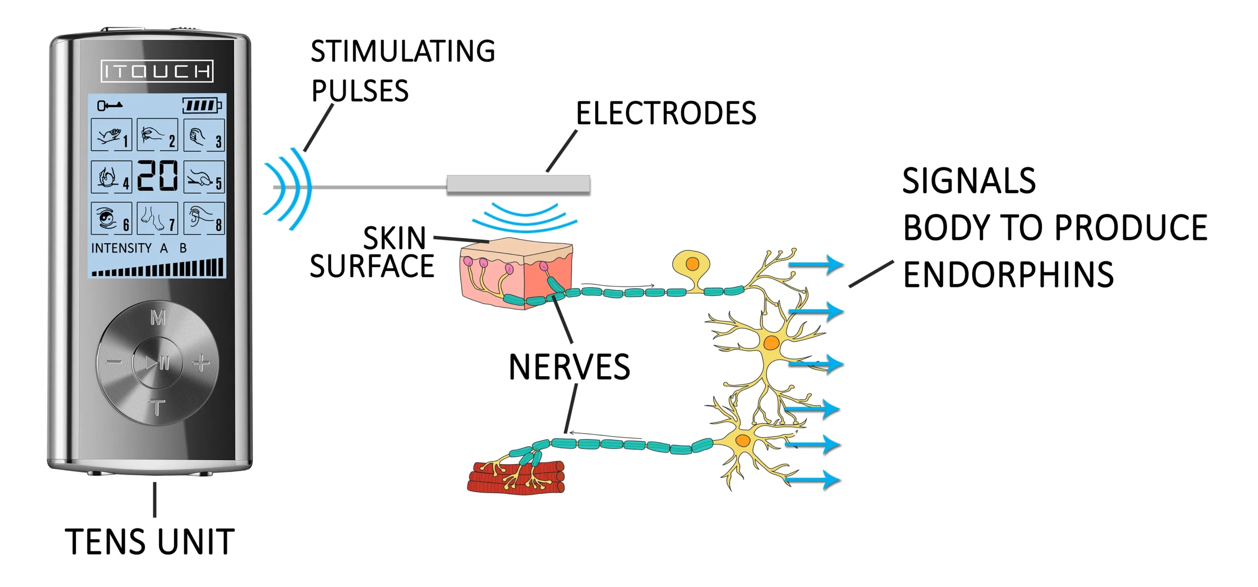 TENS Unit for Plantar Fasciitis