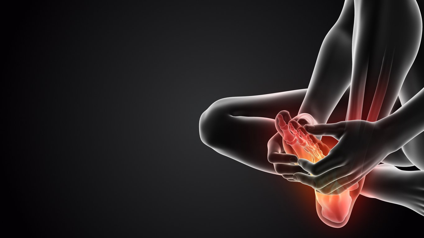 plantar fasciitis and neuropathy