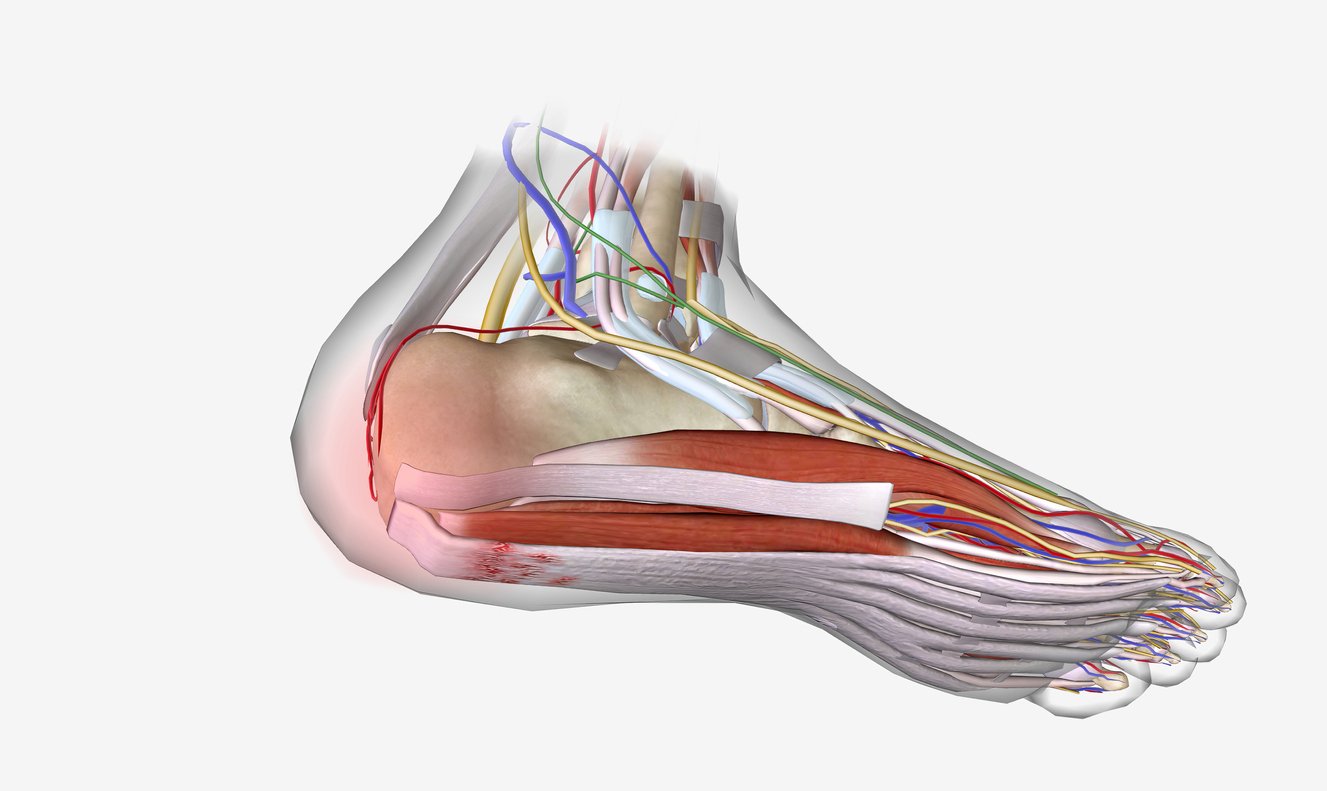 Plantar Fascia Test: Diagnosis and Treatment Guide - theheelgp.com